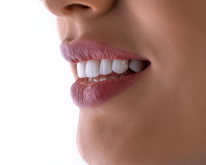 Sorriso com dentes brancos e alinhados