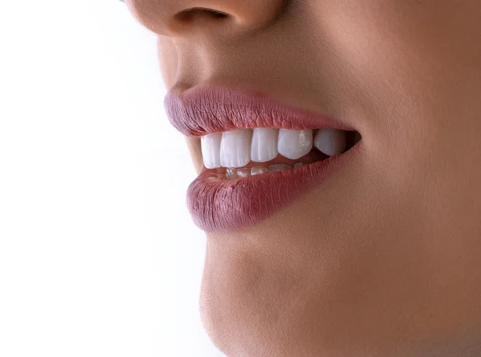 Sorriso com dentes brancos e alinhados